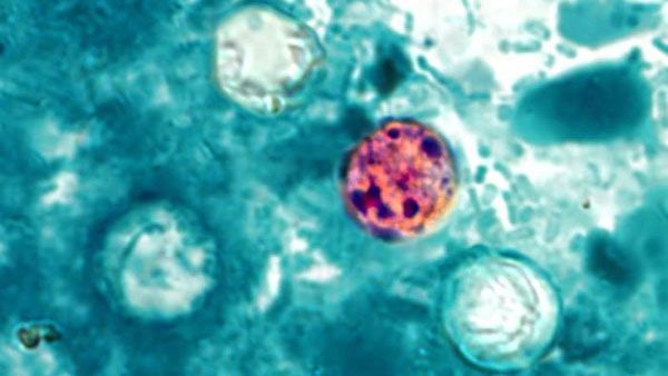 Focus at Four: Expert discusses Cyclospora after rise in Texas cases