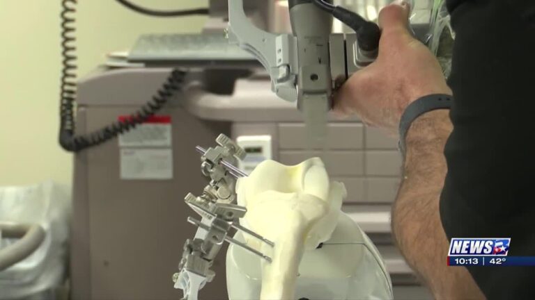 The Physicians Centre Hospital unveils knee surgery technology