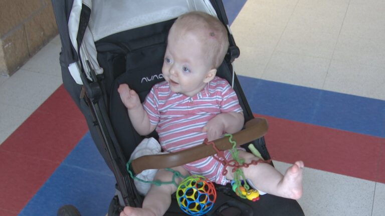 Madisonville rallies around one-year-old facing Apert Syndrome